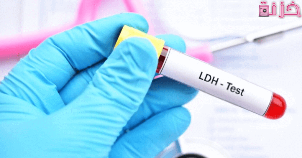 تحليل ldh
