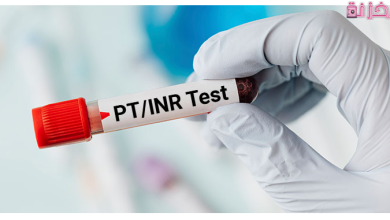 تحليل inr