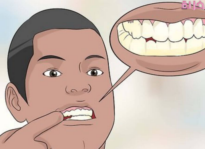 تنظيف الاسنان