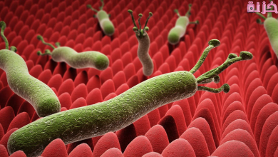 أعراض جرثومة المعدة والقولون وعلاجها