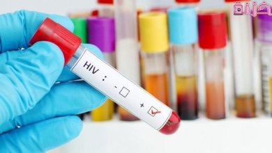 سعر تحليل الايدز في مصر