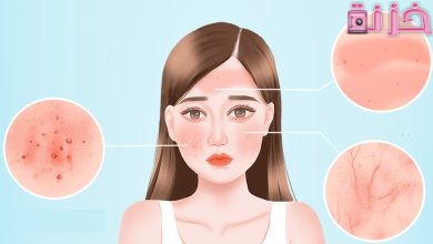 اسباب حساسية الجلد المفاجئة