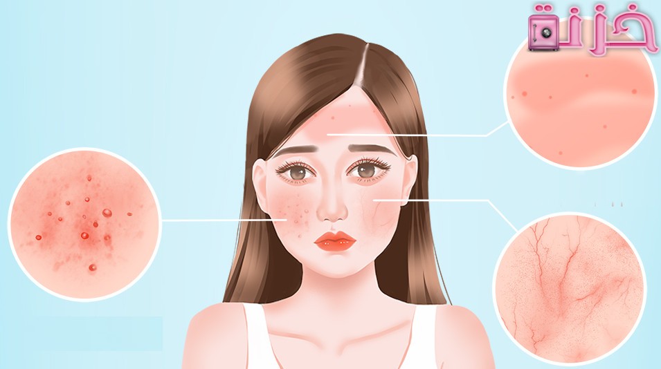 اسباب حساسية الجلد المفاجئة