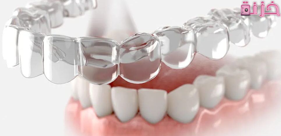سعر تقويم Invisalign فى السعودية