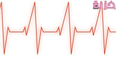 هل تخطيط القلب يكشف انسداد الشرايين